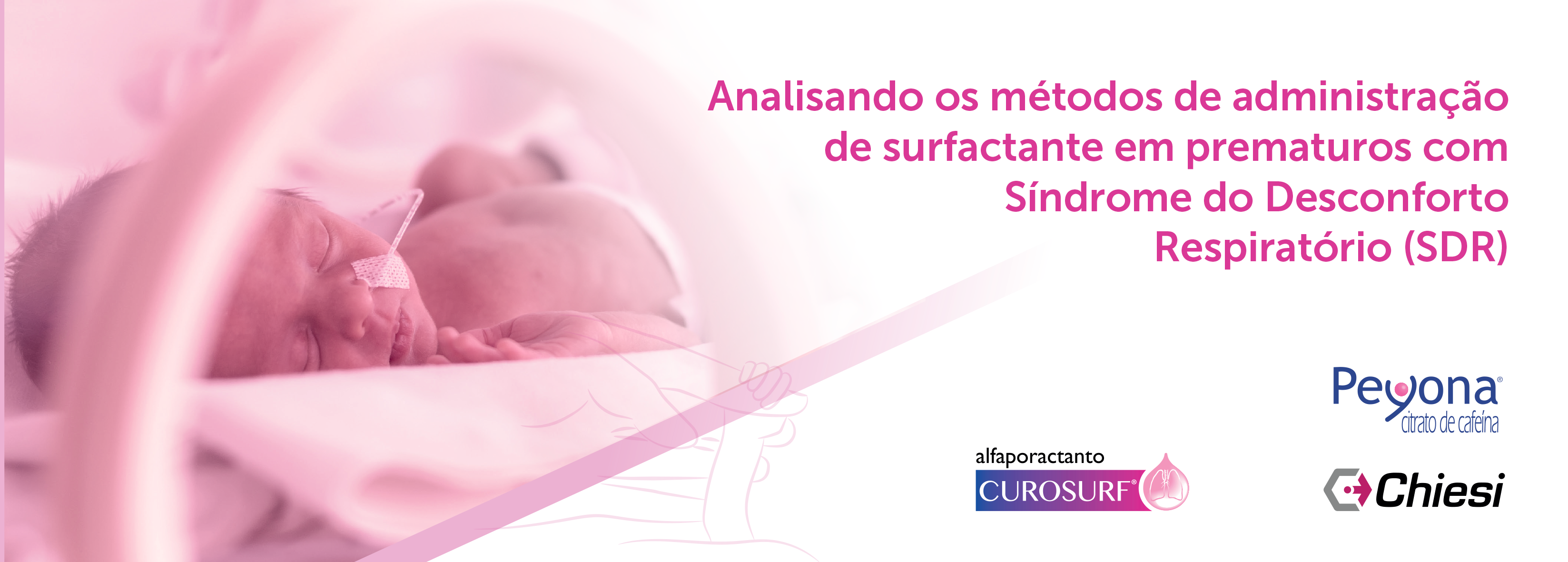 Analisando os métodos de administração de surfactante em prematuros com Síndrome do Desconforto Respiratório (SDR)